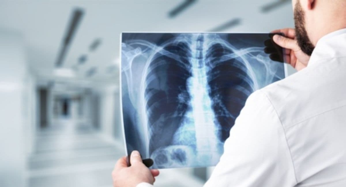 رادیو لوژی و سونوگرافی در تهران C/رادیو لوژی و سونوگرافی در تهران