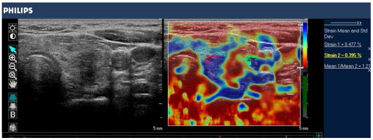 الاستوگرافی elastography/الاستوگرافی
