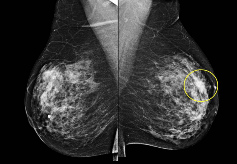 مرکز تخصصی ماموگرافی s/مرکز تخصصی ماموگرافی