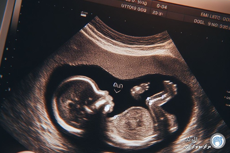 F/شرایط سونوگرافی حاملگی شرایط سونوگرافی حاملگی