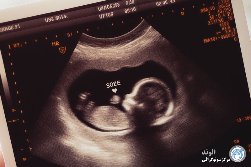 شرایط سونوگرافی حاملگی D/شرایط سونوگرافی حاملگی