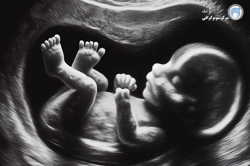 سونوگرافی چیست؟ d/سونوگرافی چیست؟