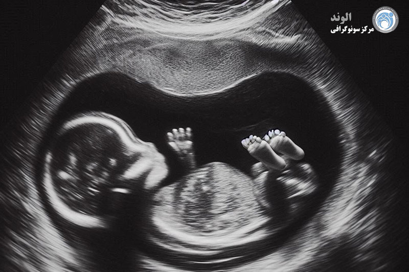 سونوگرافی خانم s/سونوگرافی خانم