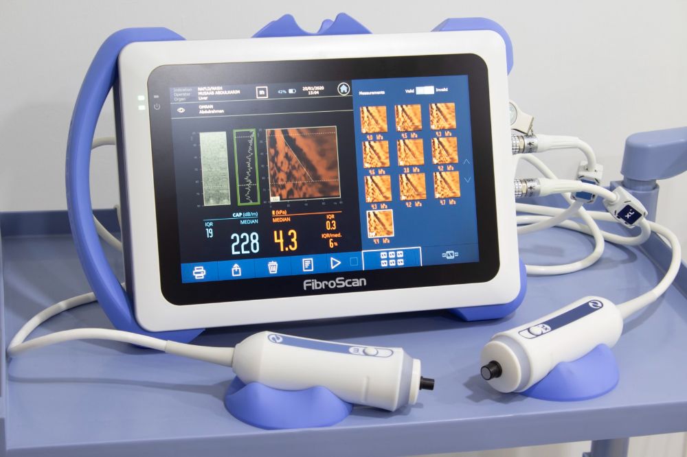 c/فیبرواسکن کبد چیست