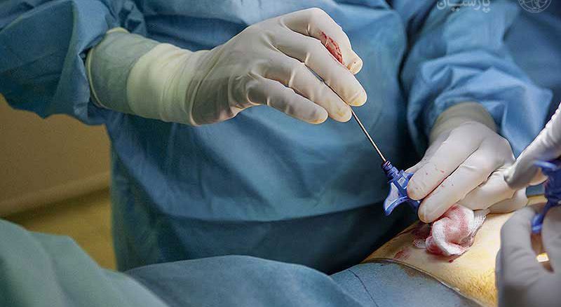 بیوپسی سینه در تهران e/بیوپسی سینه در تهران